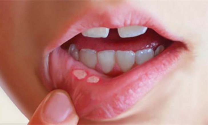 12-cancer-symptoms-you-are-most-likely-to-ignore_13