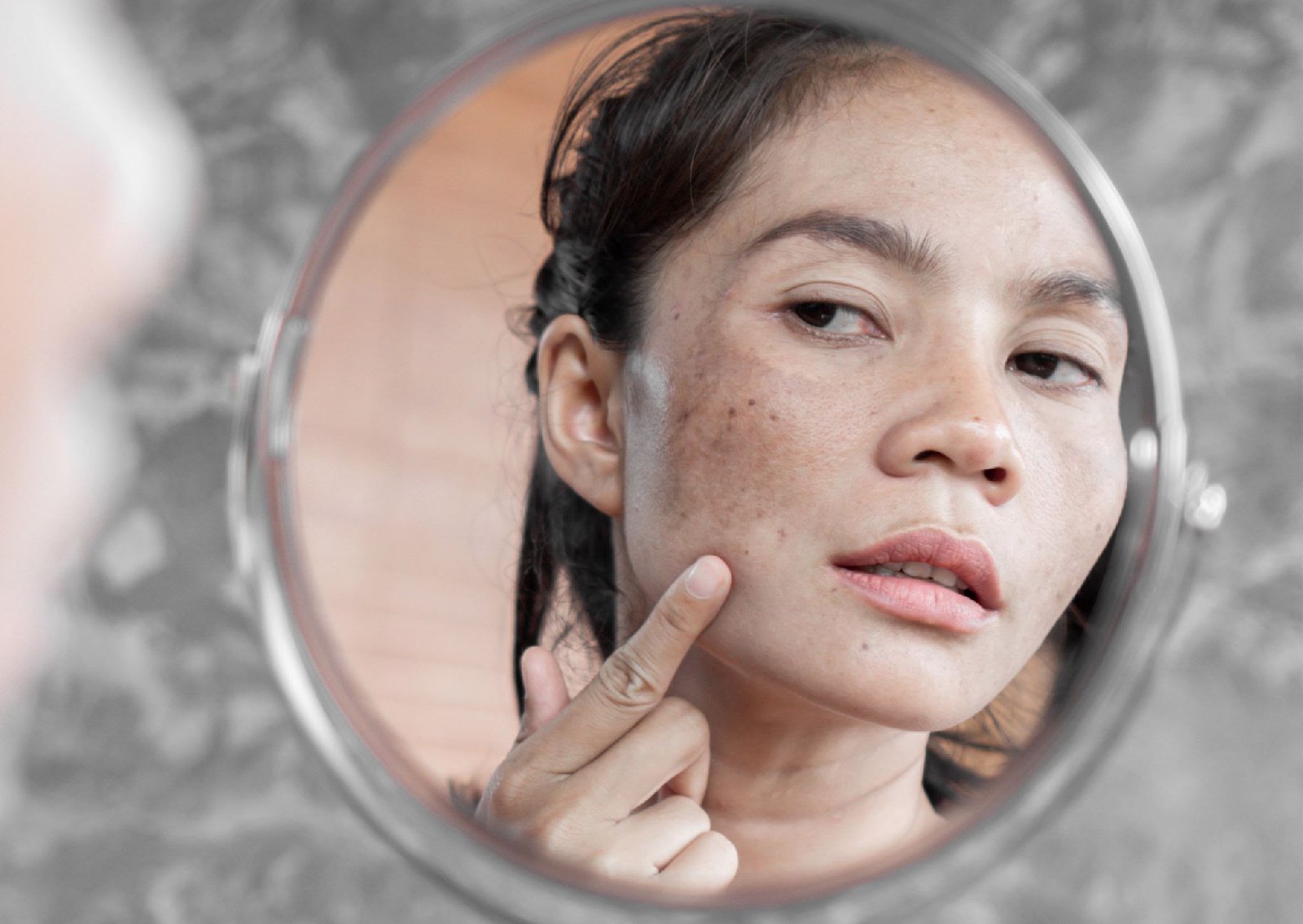 Eczema: Common Symptoms, Causes & Natural Remedies_2