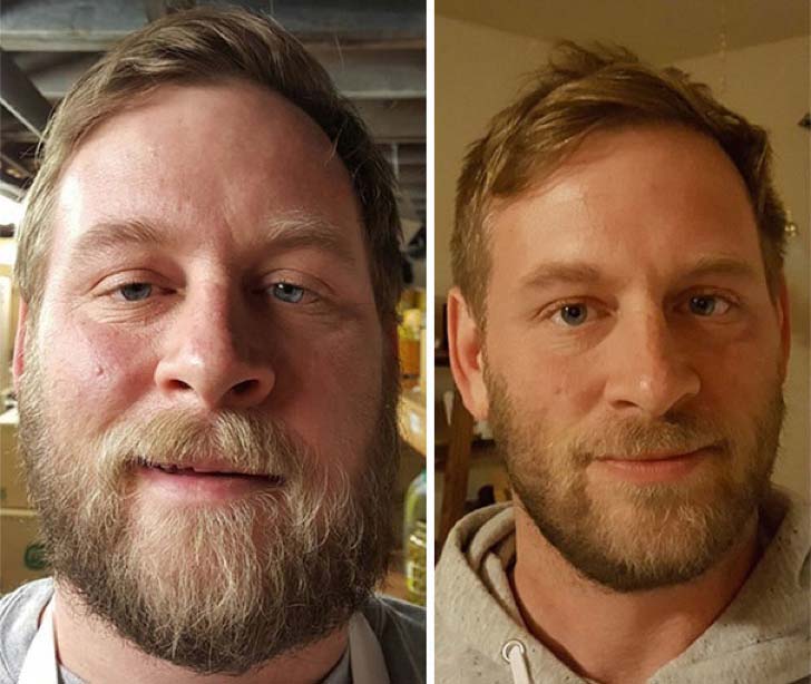 these-10-before-and-after-photos-show-what-happens-when-you-stop-drinking_2