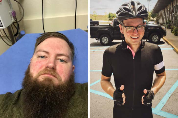 these-10-before-and-after-photos-show-what-happens-when-you-stop-drinking_4