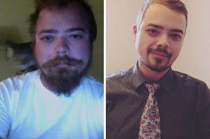 these-10-before-and-after-photos-show-what-happens-when-you-stop-drinking_6